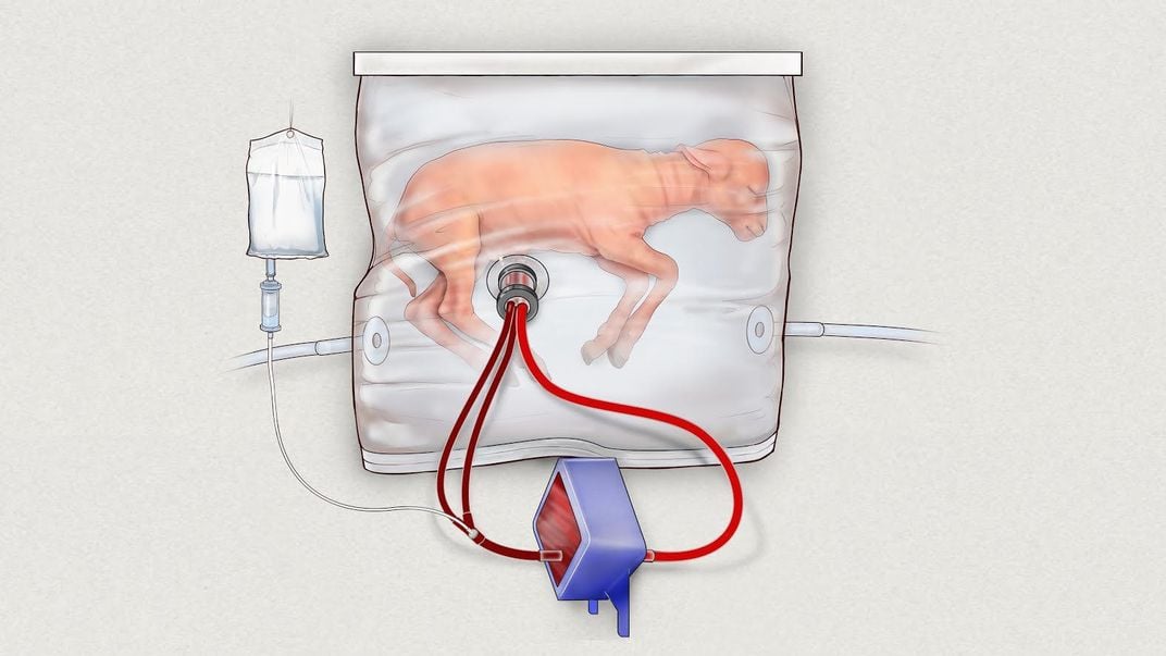 Will This Artificial Womb One Day Improve the Care of Preemies?