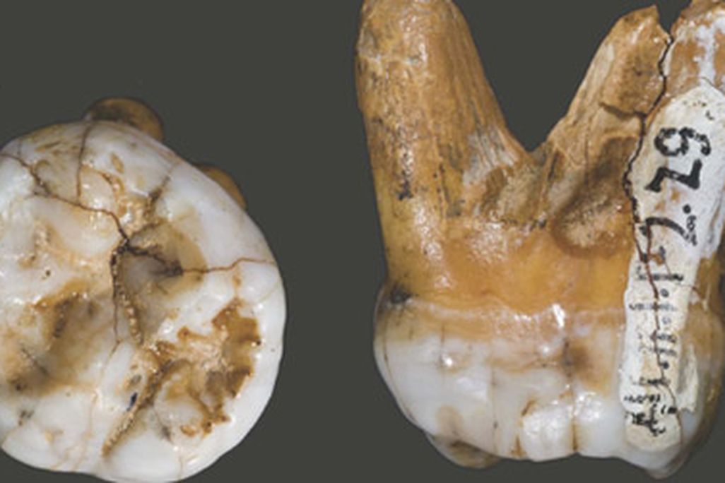 The molar tooth of a Denisovan
