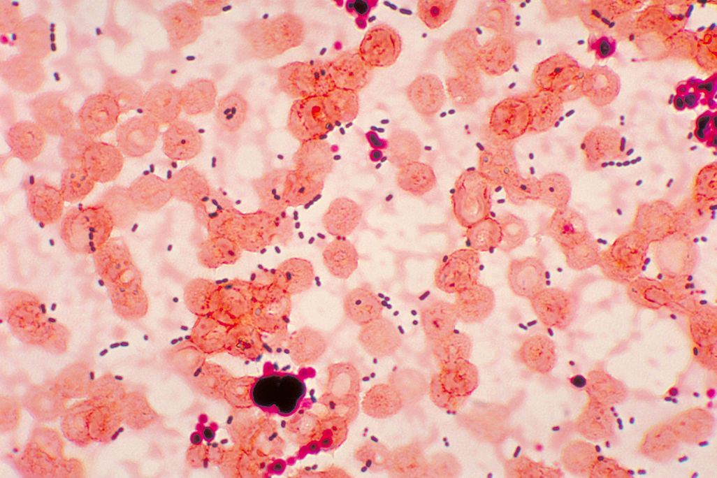 Enterococcus bacteria under microscope 