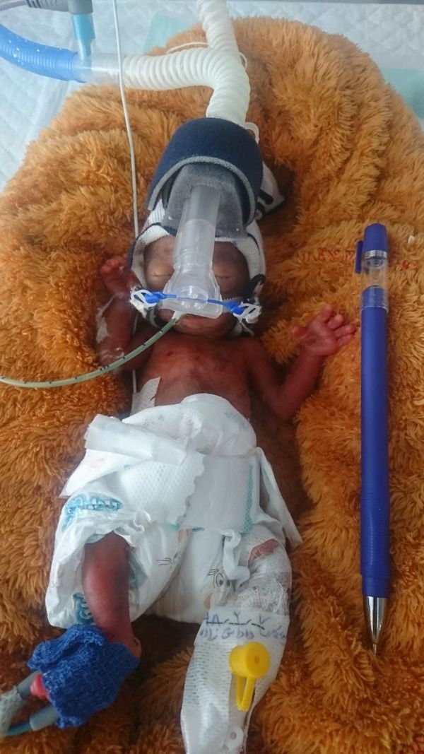 too small to fit thumbnail