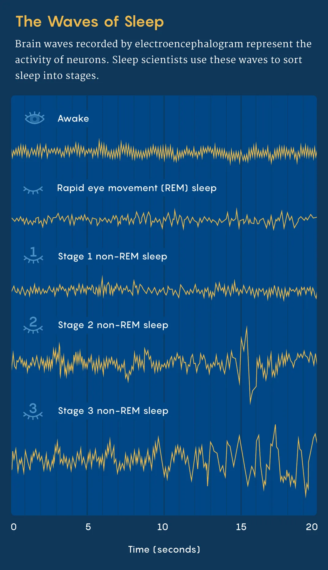 a graphic demonstrates the change in EEG readings across different phases of sleep