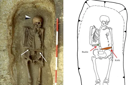 The man's limb appears to have been removed by blunt force trauma and a knife was later secured in its stead.