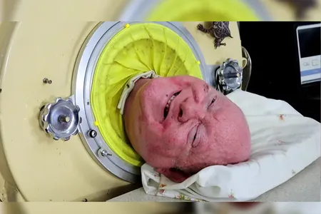 Paul Alexander died on March 11 at age 78.