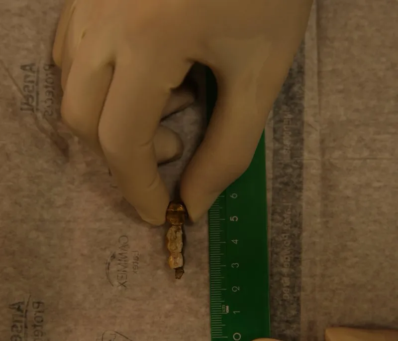 Hitler's Teeth