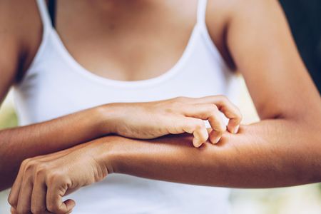 A woman scratches her forearm.