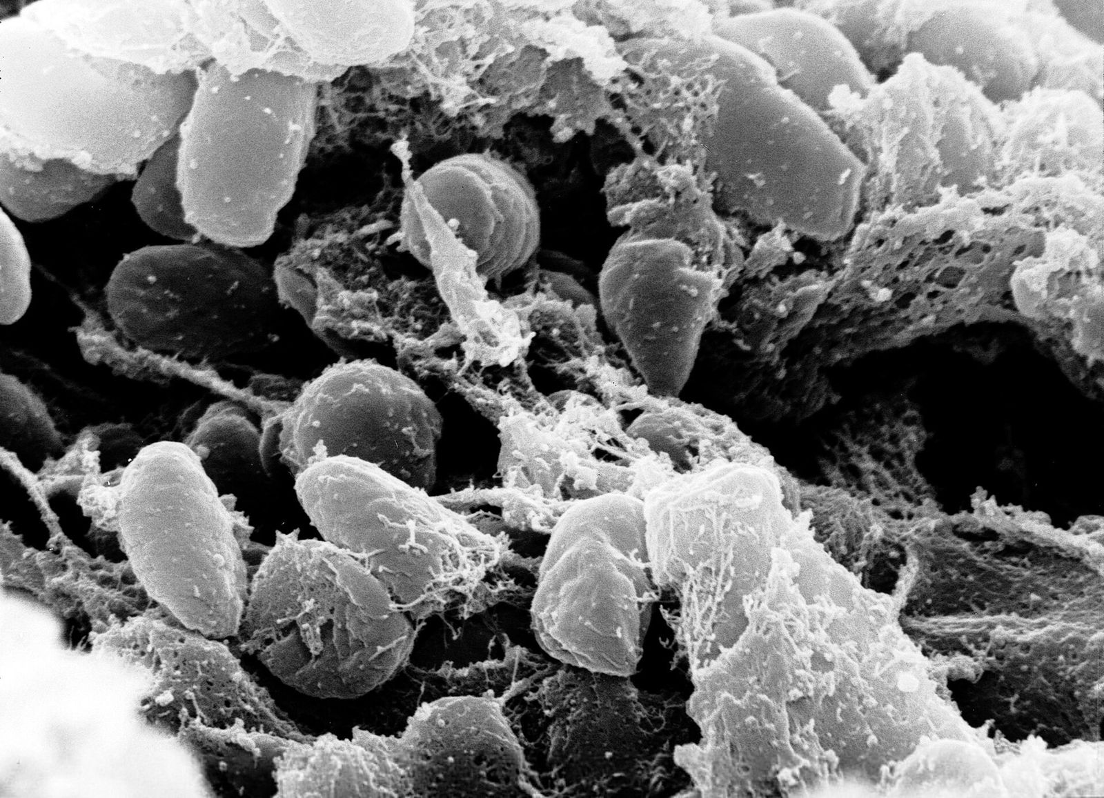 Employee of a Russian Anti-Plague Lab Dies of Pneumonia, Sparking Concerns Over the Disease Behind the Black Death. Here's What to Know