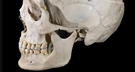 Humans are the only hominids with true chins.
