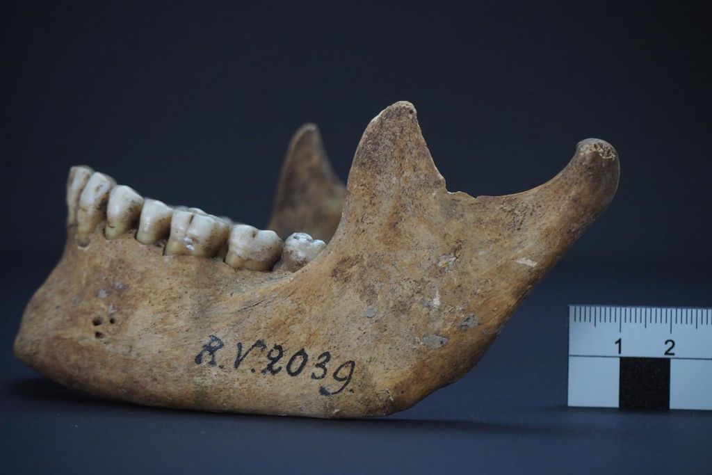A photograph of human remains, a lower jawbone labeled RV 2039