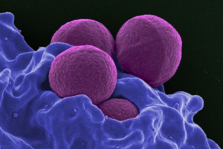 The antibiotic-resistant superbug MRSA