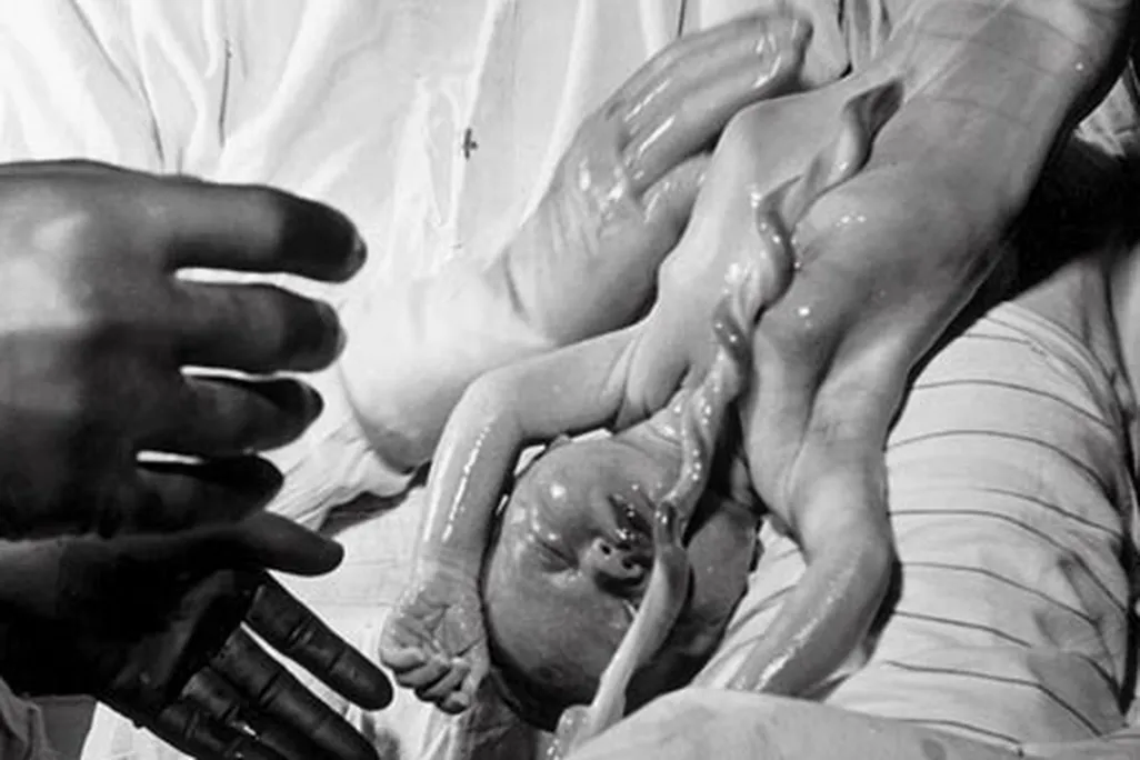 Newborn surrounded by family