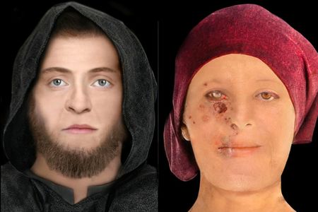 The high-status 16th-century woman (right) appears to have suffered from leprosy, a disfiguring disease that likely left its mark on her skin, tissues and bone.
