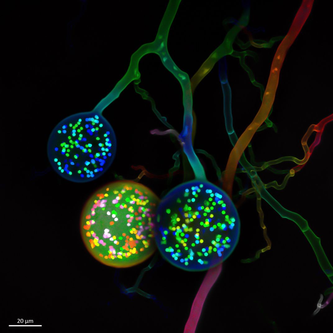 An image of spores of a soil fungus.