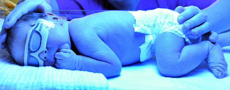 Phototherapy for eczema in babies 