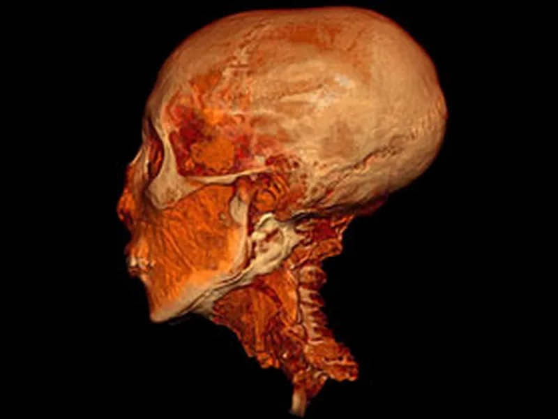 Tutankhamun's Face Revealed in Stunning Detail in New 3D