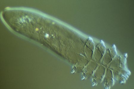 Say hello to your faithful friend Demodex folliculorum.