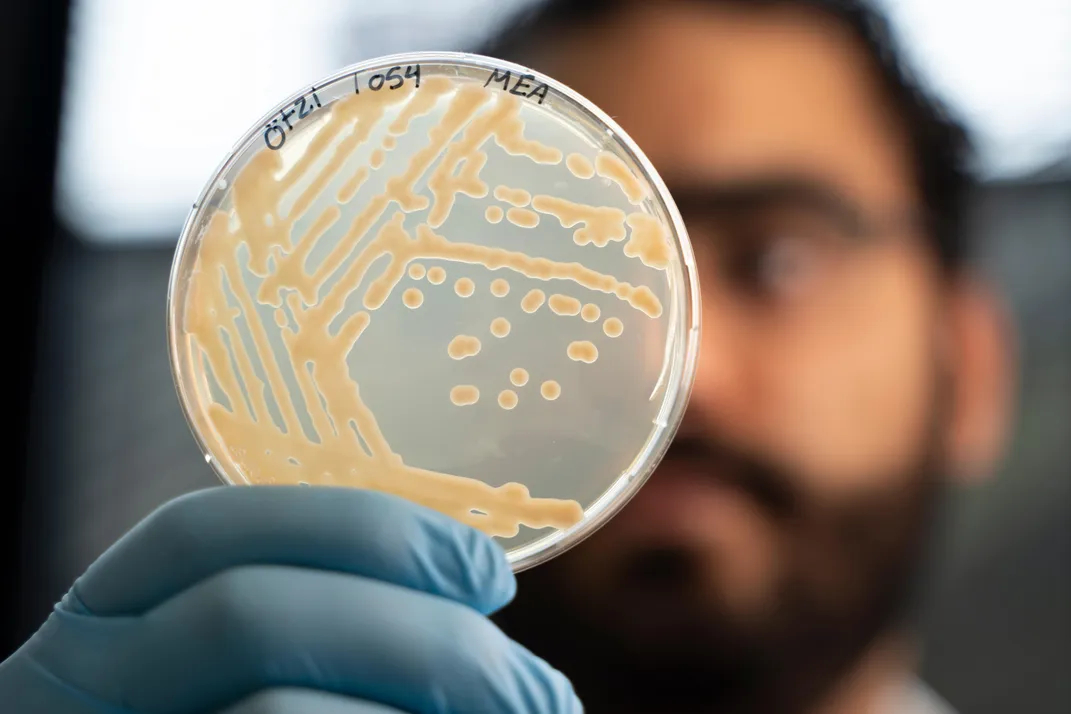 A person holding up a sample of yeast