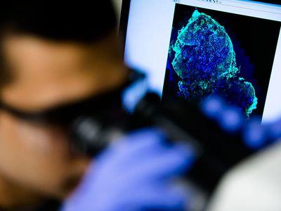 Sumit Bhatnagar, a PhD student in chemical engineering at the University of Michigan, inspects tumor cells used in developing a new diagnostic pill.