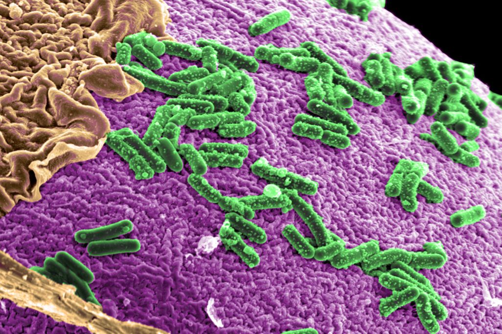 Gut Microbiome