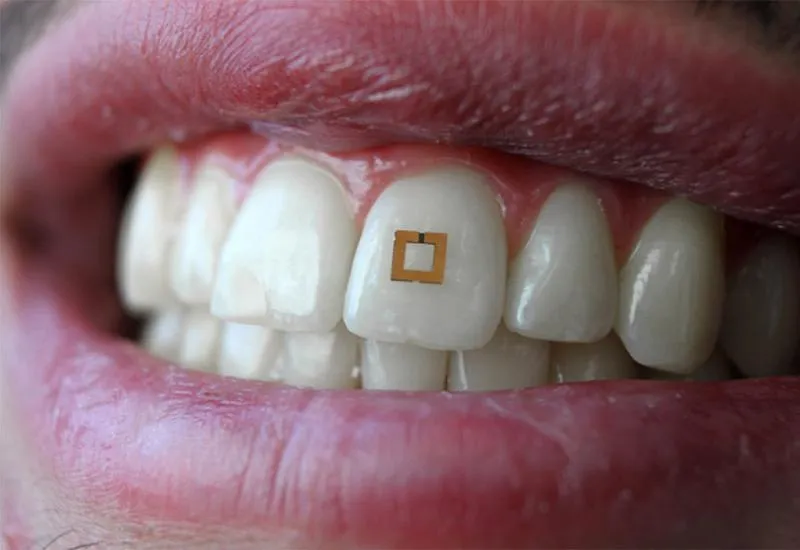 tooth sensor.jpg