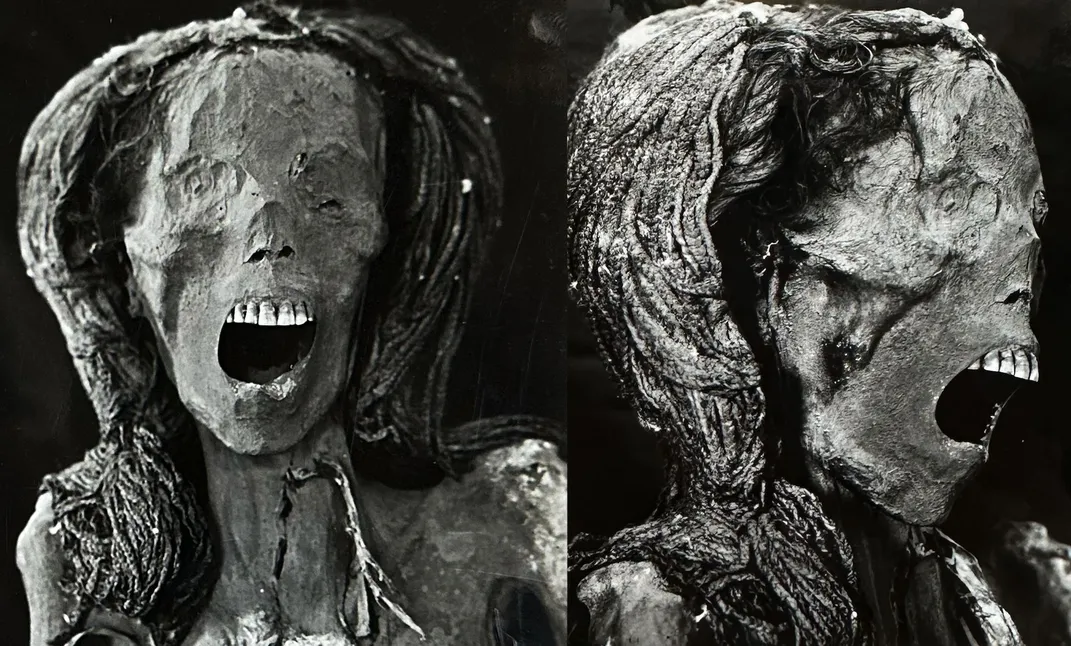 The front and right profile of the head of the Screaming Woman mummy