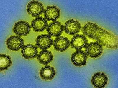 H1N1 influenza virus particles shown in a colorized transmission electron micrograph