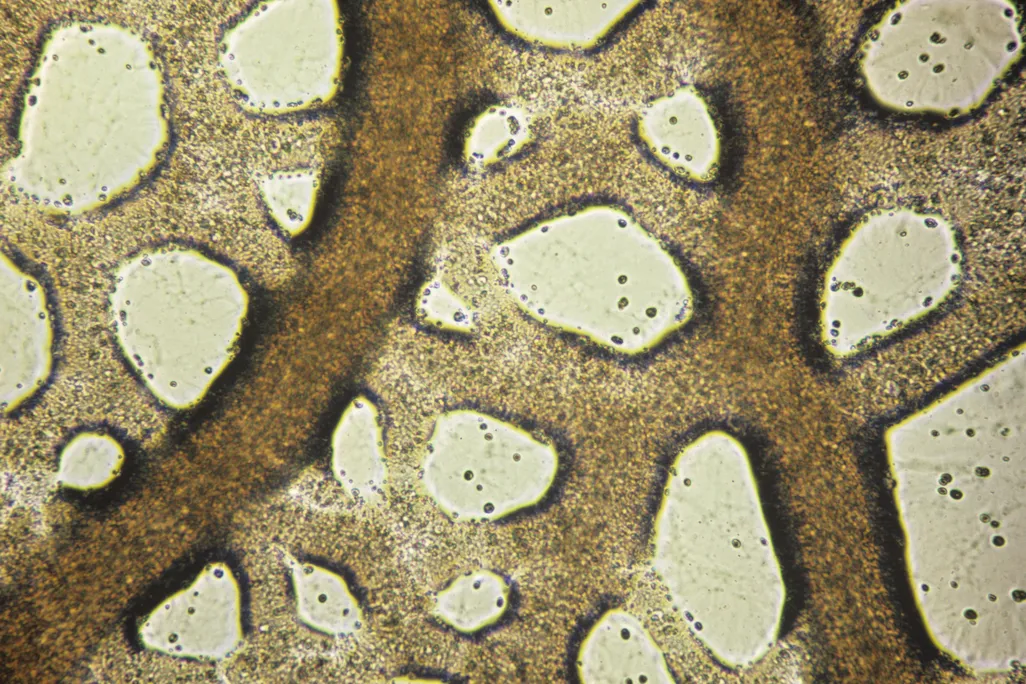 slime mold