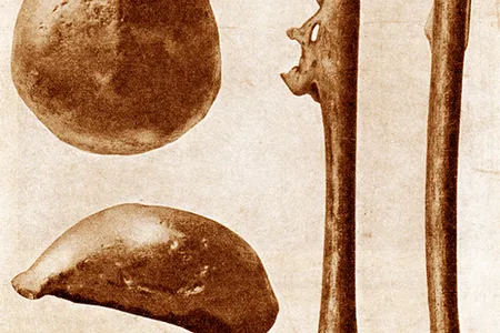 Eugene Dubois discovered the first hominid fossils in Indonesia when he unearthed Homo erectus bones at Trinil in 1891 and 1892.