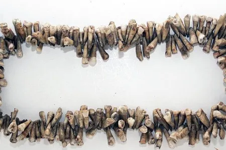 "Painless Parker" wore a necklace of teeth to lure in achy victims. 