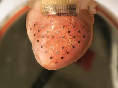 This "heart sock" is dotted with sensors that can detect the intricate inner workings of the heart. 