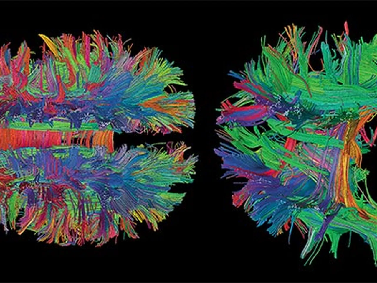 Beauty of the Brain