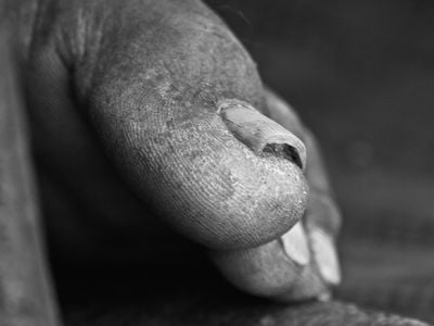 Your big toe is an example of how "boundary conditions" can affect the curvature of a nail.