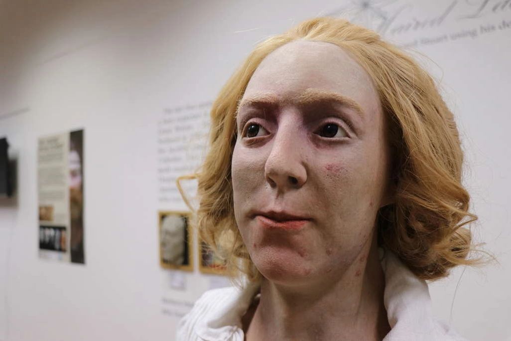 Bonnie Prince Charlie facial reconstruction