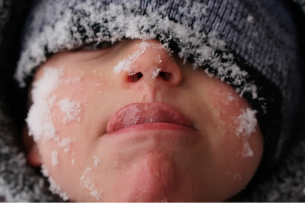 1 - Whether you “win” or “lose” a snowball fight, you’re probably walking away with a frosty face full of flakes.