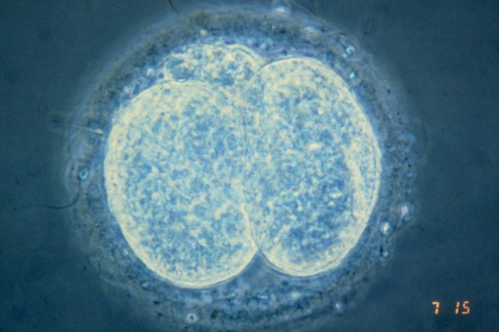 Human embryo