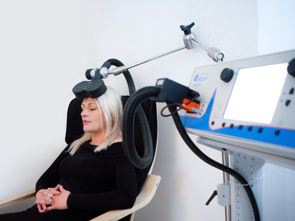 transcranial magnetic stimulation