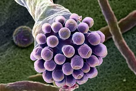 The beauty of this mutant strain of the fungus Trichoderma reesei belies the organism’s potential for dismantling biomass.