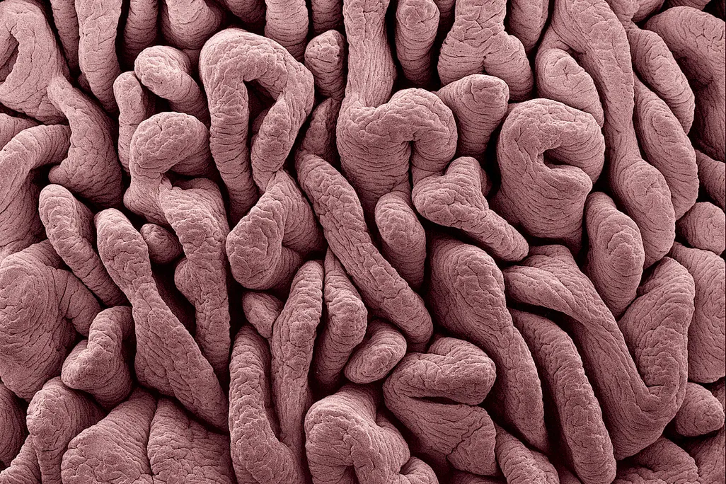 Intestines