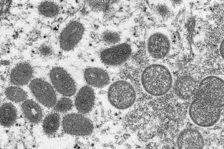 The monkeypox virus.