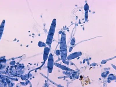 Trichophyton simii, shown here under a microscope, is one of 40 species of fungi that can cause ringworm infections.