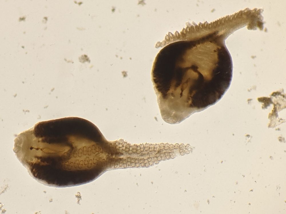 two brown horseshoe-crab-shaped parasites under magnification
