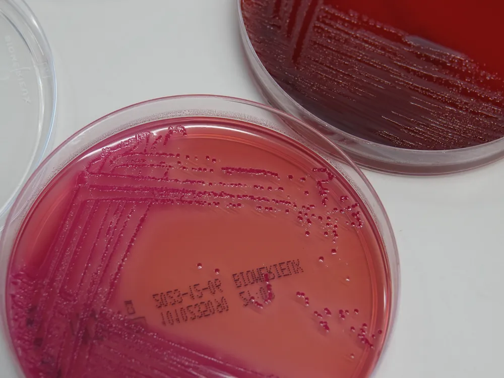 A petri dish with bacteria in a red-colored culture medium