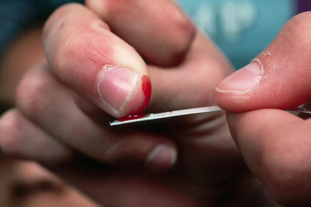 diabetes test strip