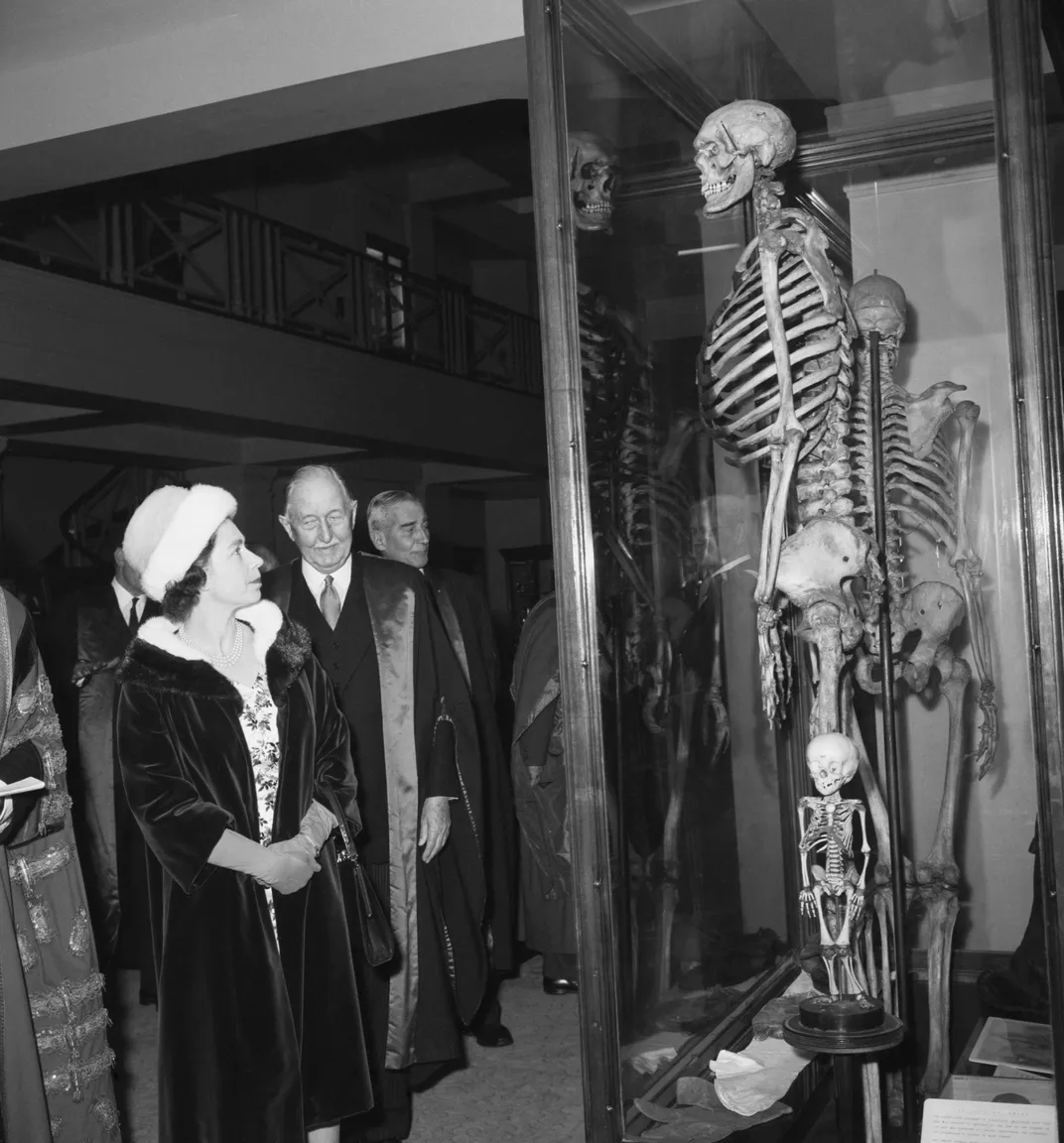 Elizabeth II views the skeleton of Charles Byrne during a visit to the Hunterian Museum in 1962.