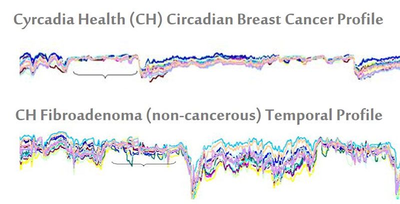 Breast cancer detector using wearable ultrasound patches fits inside a  woman's bra - Study Finds