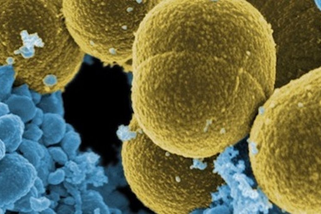 Scientists are learning that bacteria play a crucial role in our digestion of food, including our intake of fats.