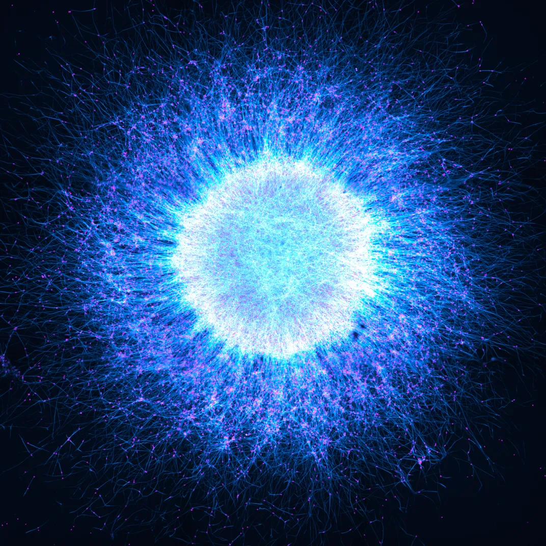 a bright blue orb with a darker blue-purple outer orb of small tendrils of brain cells