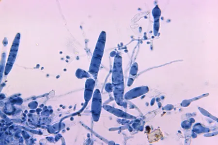 Trichophyton simii, shown here under a microscope, is one of 40 species of fungi that can cause ringworm infections.