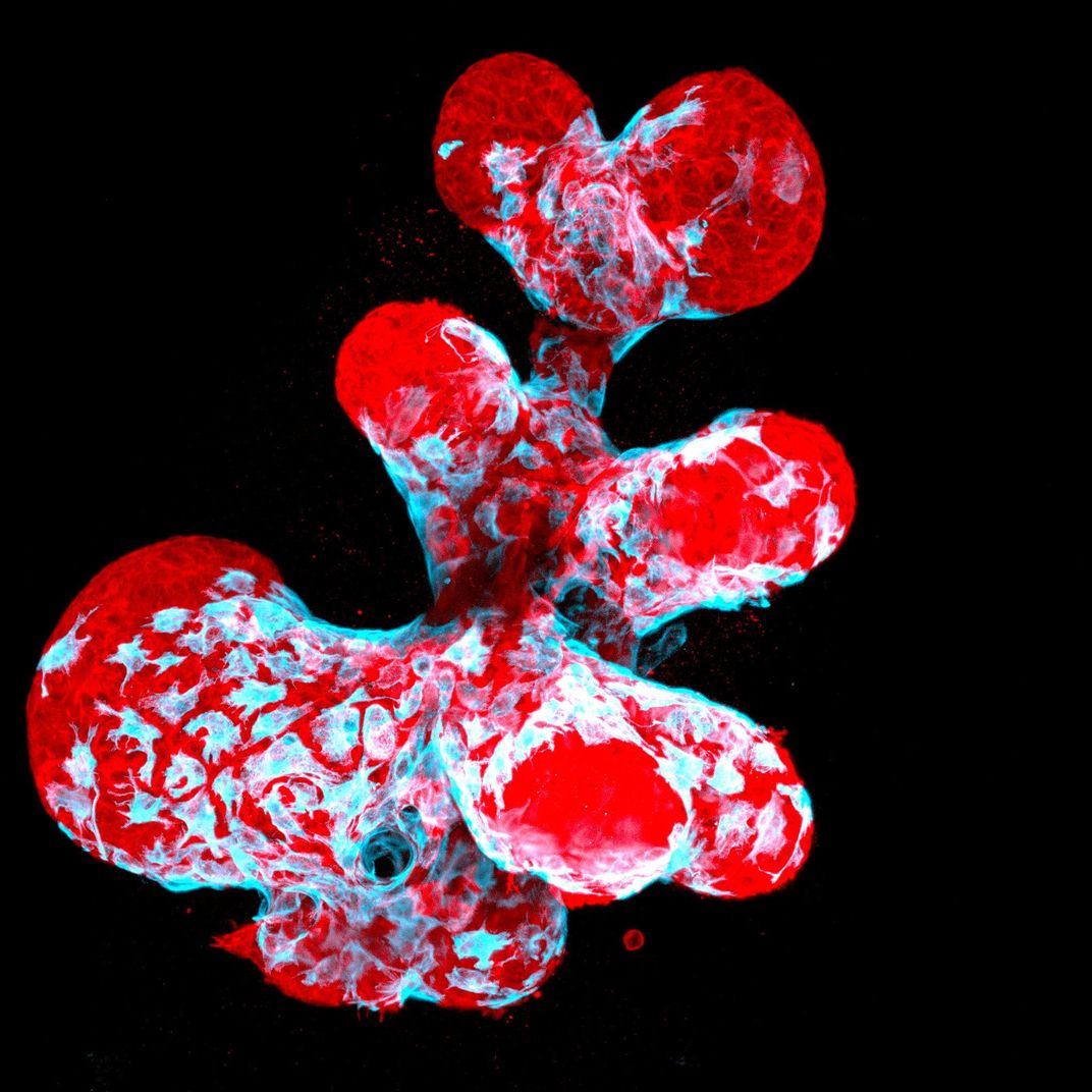 12th Place: “Breast organoid showing contractile myoepithelial cells (blue) crawling on secretory breast cells (red)” by Jakub Sumbal