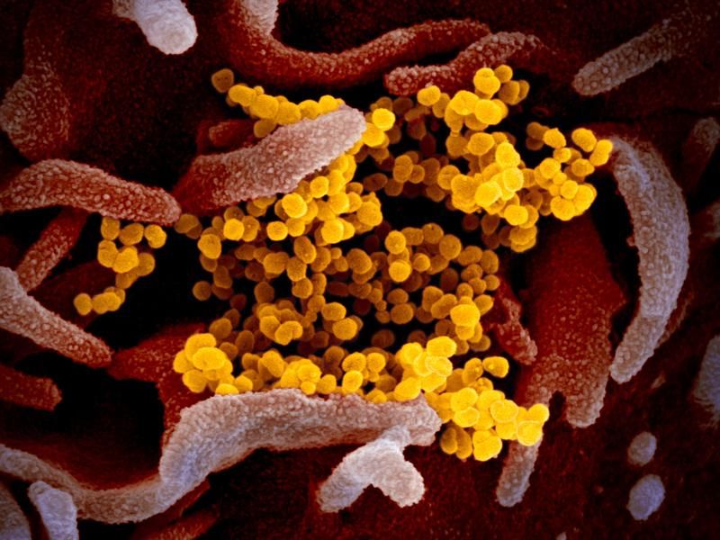 Why Immunity to the Novel Coronavirus Is So Complicated