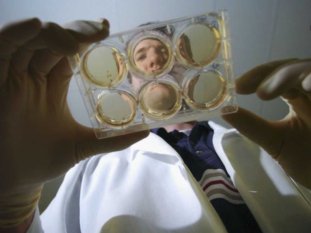 The face of a researcher is seen through a plate of cultures they are holding